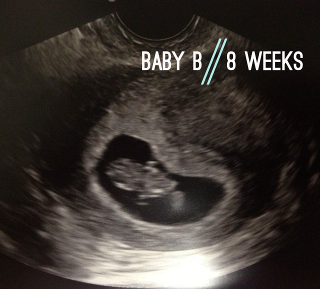 Baby B // 8 weeks